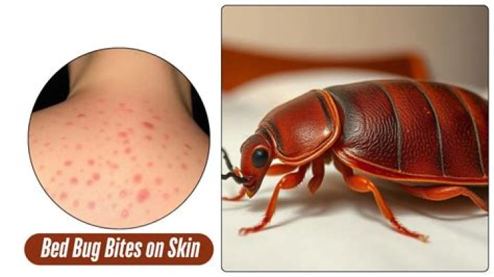 Are there any side effects from bed bug bites